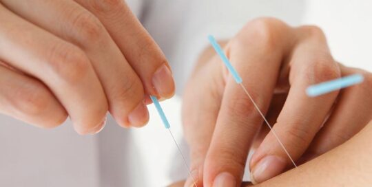 complete therapy Medical Acupuncture