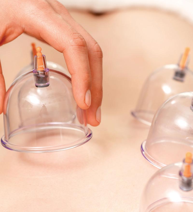 complete therapy Cupping